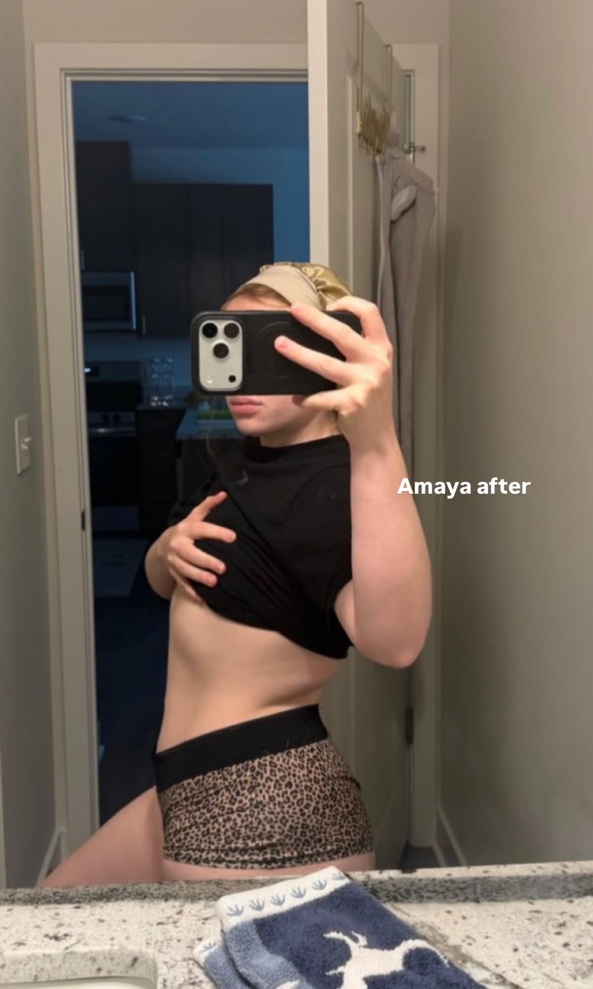 imageAfter