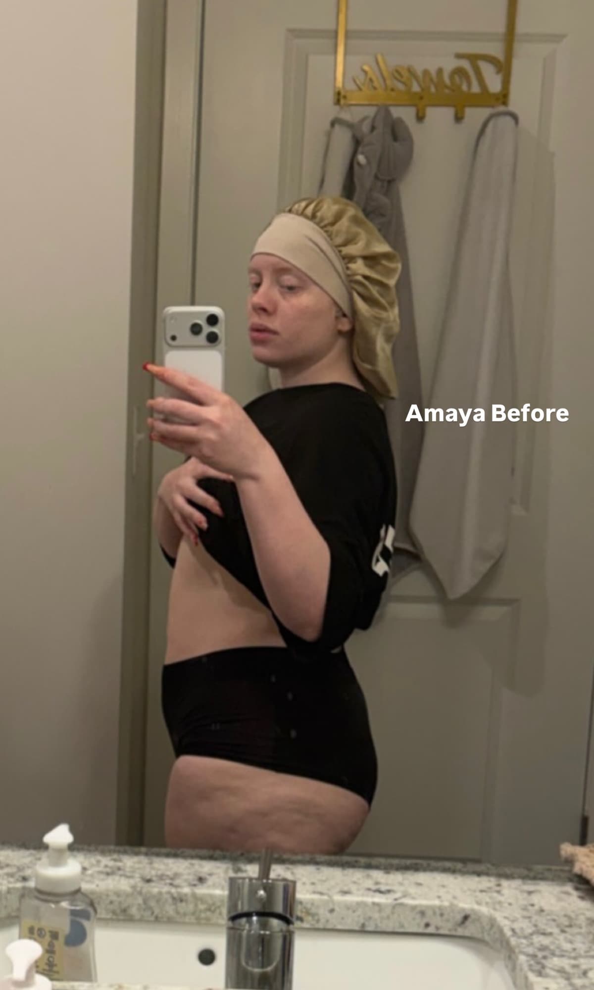 imageBefore