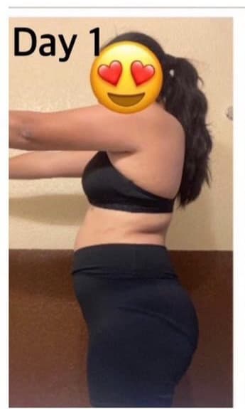 imageBefore